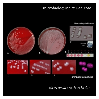 moraxella, branhamella